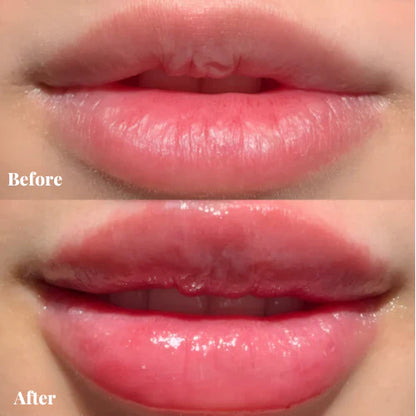 Lip Boost Kit-