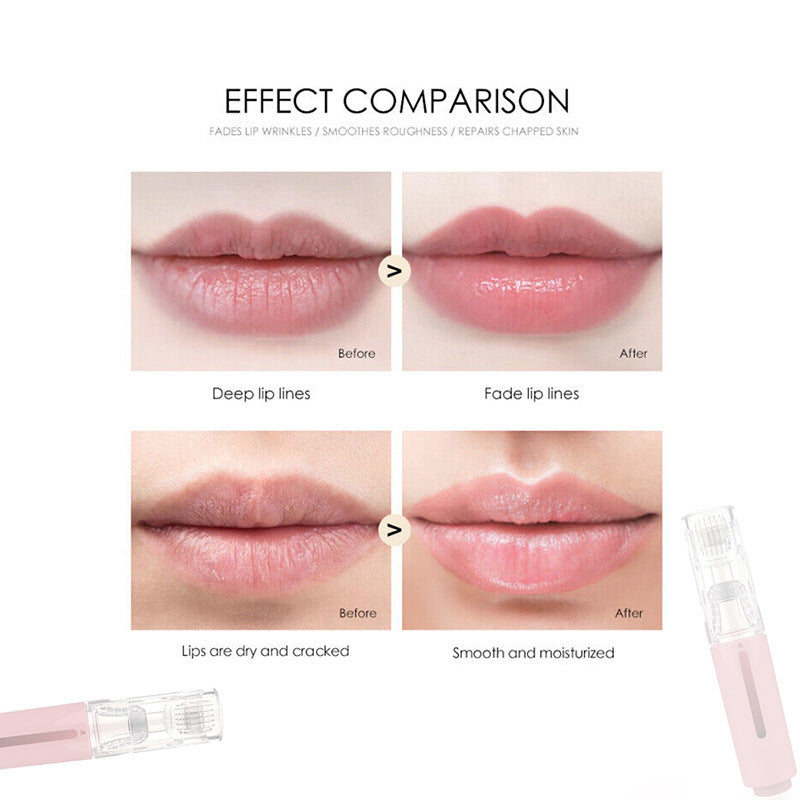 Lip Boost Kit-