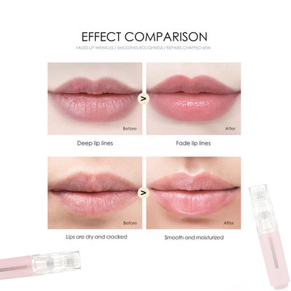 Lip Boost Kit-